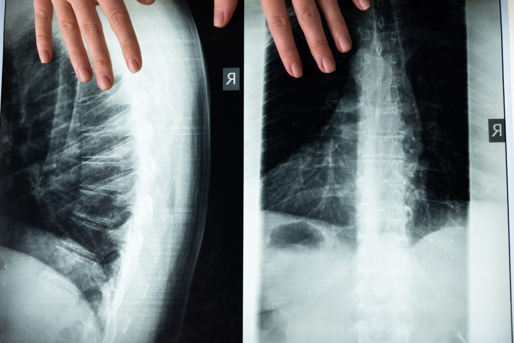 Best Lumbar Support Cushions for Office Chairs An illustrative close-up of a spine X-ray with hands, highlighting medical imaging and anatomy.